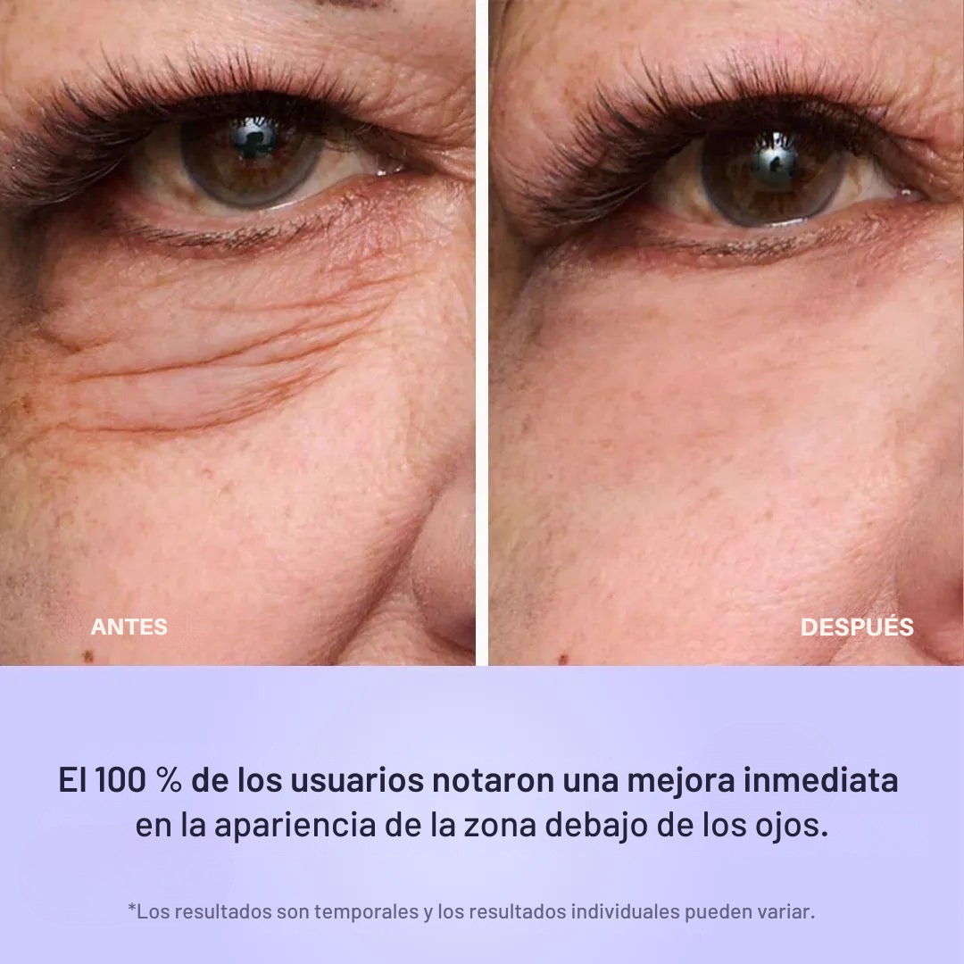 Reafirmante Instantáneo Contorno de Ojos – Compatible con Maquillaje