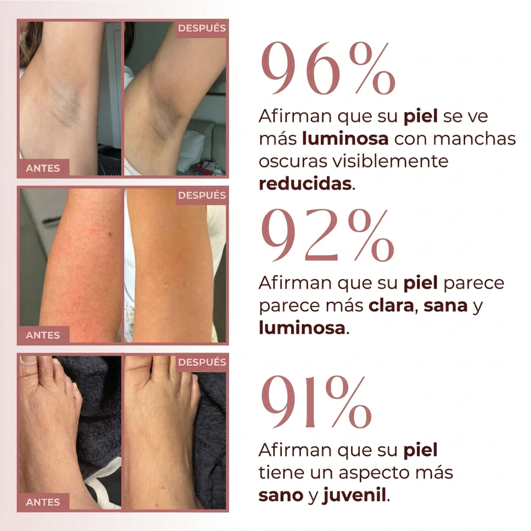 Cosmivella - Exfoliante Corporal Iluminador de Cúrcuma y Ácido Kójico - Piel Suave y Tono Uniforme - 200ml
