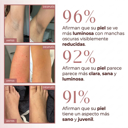 Cosmivella - Exfoliante Corporal Iluminador de Cúrcuma y Ácido Kójico - Piel Suave y Tono Uniforme - 200ml