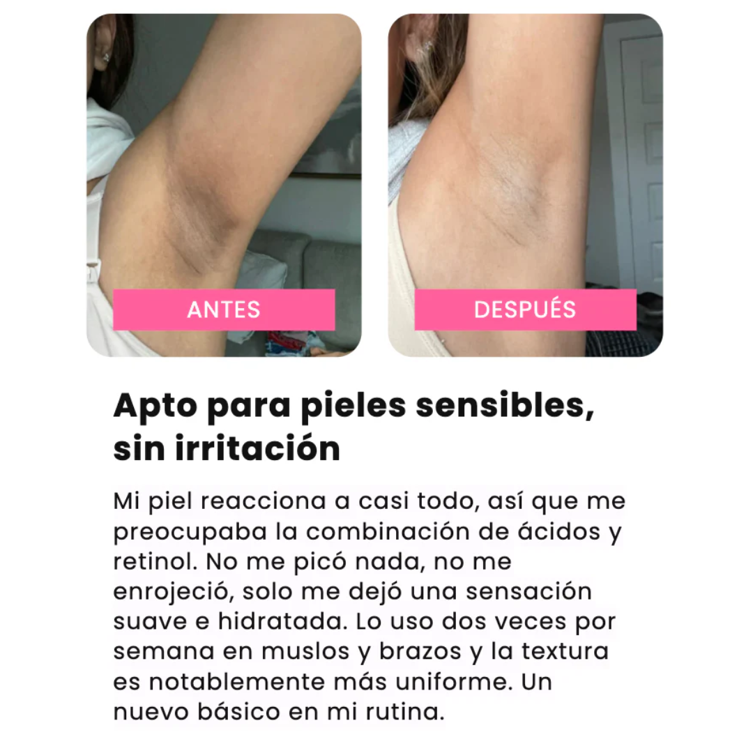 Cosmivella - Exfoliante Corporal Iluminador de Cúrcuma y Ácido Kójico - Piel Suave y Tono Uniforme - 200ml