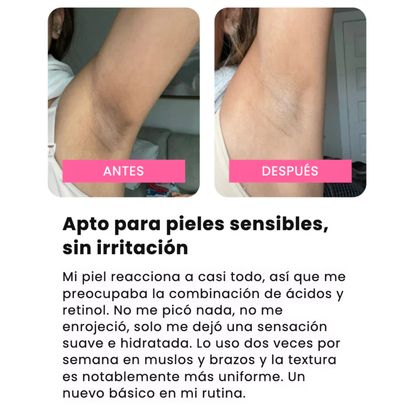 Cosmivella - Exfoliante Corporal Iluminador de Cúrcuma y Ácido Kójico - Piel Suave y Tono Uniforme - 200ml